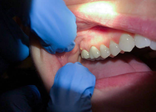Best Emergency Broken Tooth Repair in Eden, TX