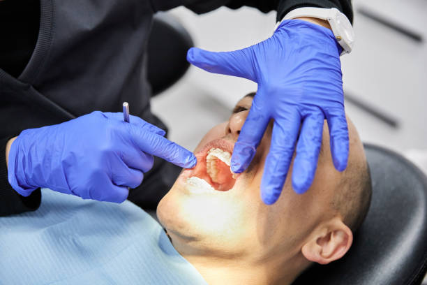 Best Emergency Treatment for Toothache in Eden, TX